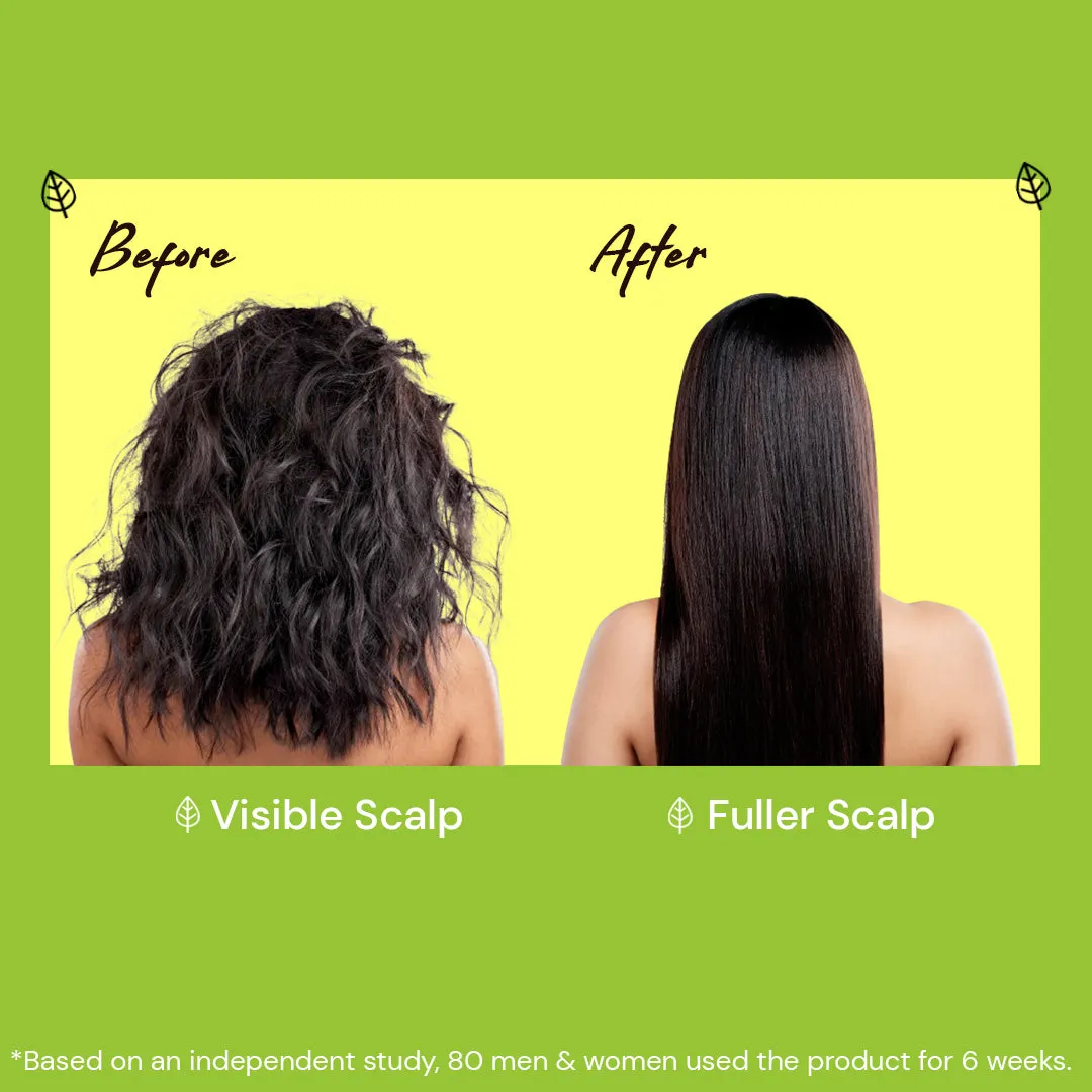 atulya Amla & Bhringraj Hair Oil - 200ml (Buy 3 Products & Get Rs.300 Off)