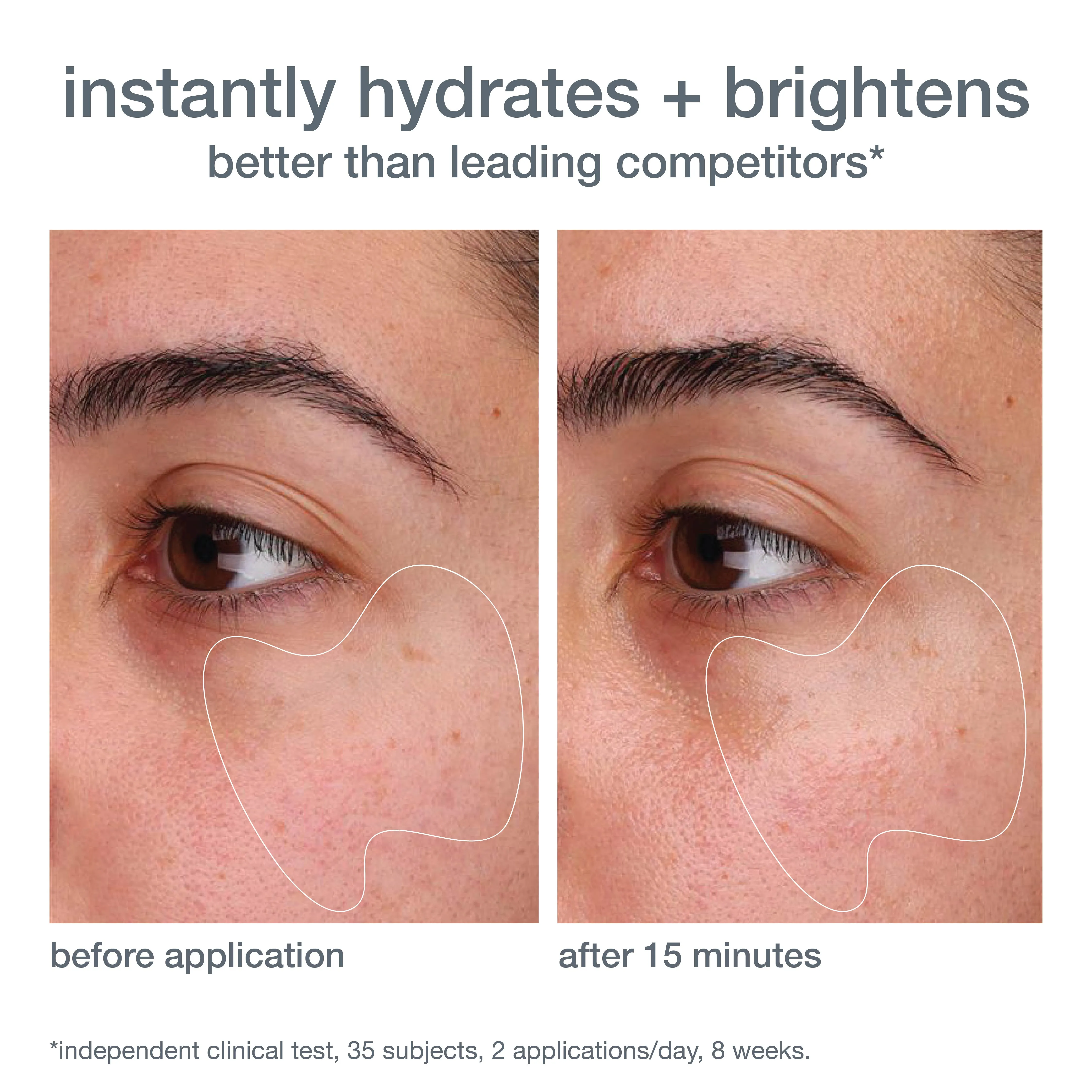Biolumin-C Gel Moisturiser with Vitamin C